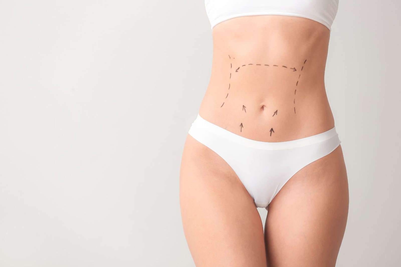 AbdominoplastiaServiciosDraSara1