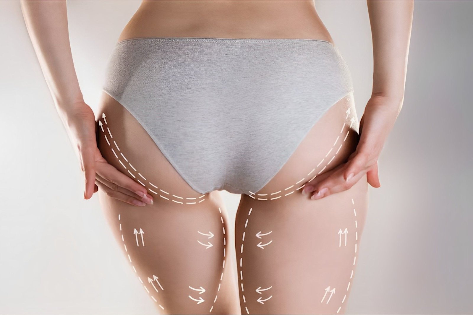 GluteoplastiaServiciosDraSara